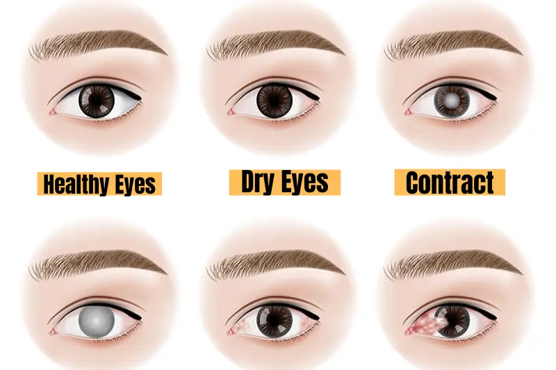 what are eye diseases and conditions