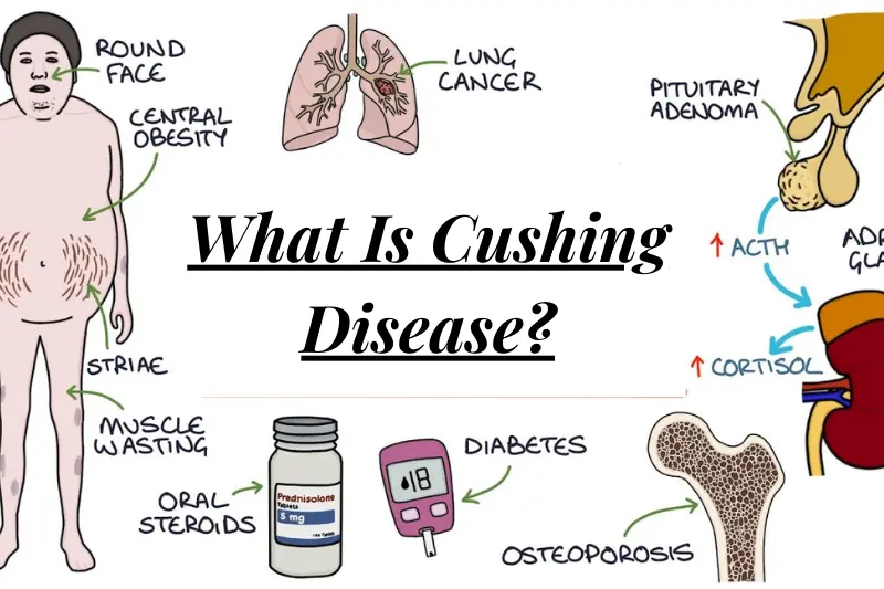 what is cushing disease