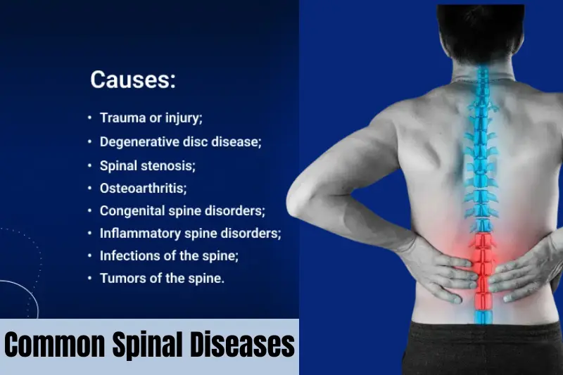 common spinal diseases