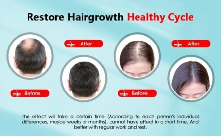 Achieve Healthier Hair with the LED Esthetics Hair Growth Device