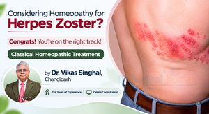 Best doctor for Herpes zoster Treatment